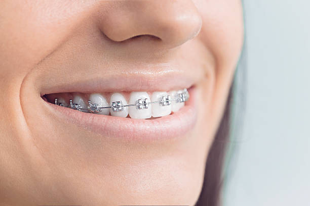 Best Wisdom Tooth Removal  in Essex Fells, NJ